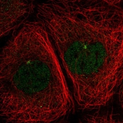 DNAL1 Antibody, Novus Biologicals 25 &mu;L, Unlabeled:Antibodies, Polyclonal
